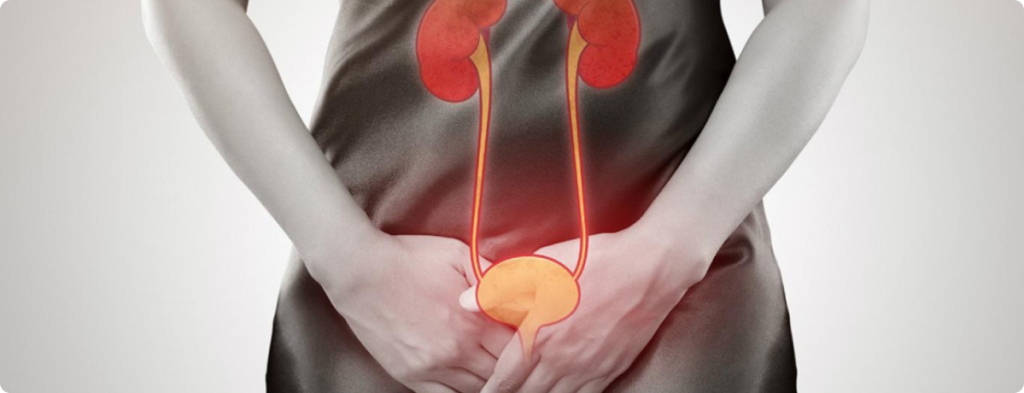 infeccion-urinaria-header